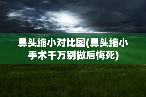 鼻头缩小对比图(鼻头缩小手术千万别做后悔死)